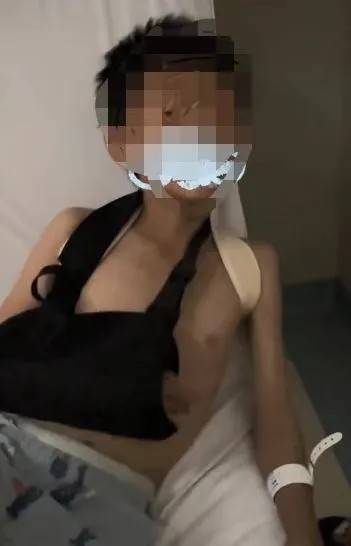 赤峰市教育局介入<strong></p>
<p>虚拟币app源代码</strong>，家长称：孩子拨弄开关被另一班班主任打伤