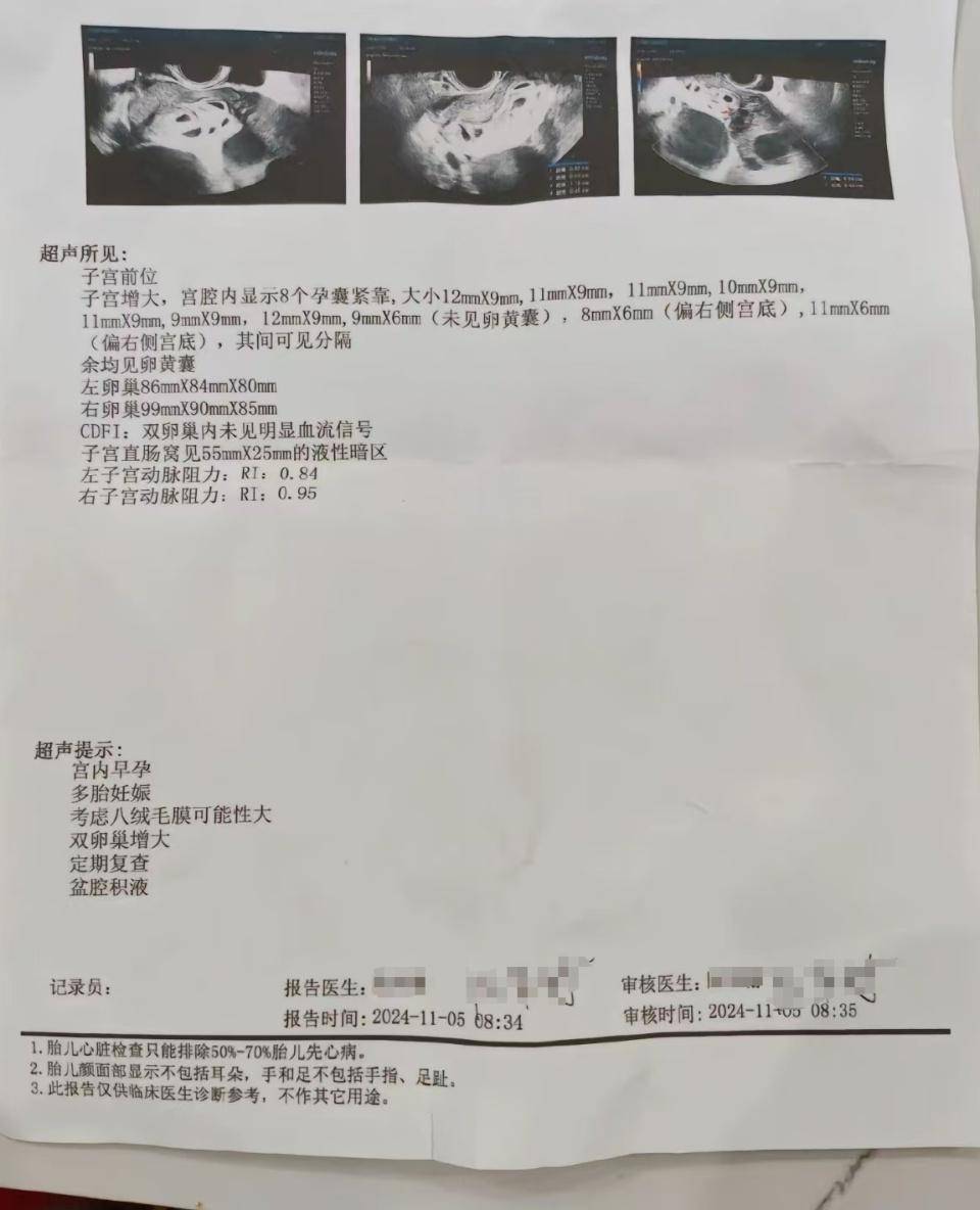 怀上9胞胎女子今日进行减胎手术：分两次进行<strong></p>
<p>虚拟币提现人民币</strong>，第一次减去四个胚胎，第二次减去三个
