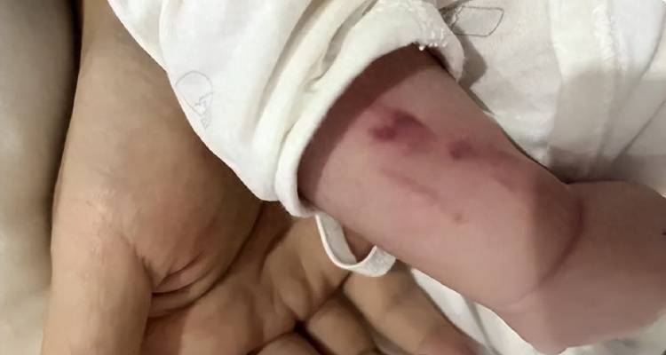 广西一男婴在月子中心被照料20天：身上2处骨折<strong></p>
<p>cstk虚拟币</strong>，育婴室监控无法查看