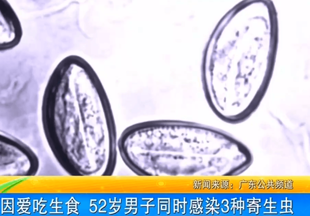 女子体内排出10米长绦虫<strong></p>
<p>虚拟币wscapp</strong>！原是两年前旅游时吃了这种食物