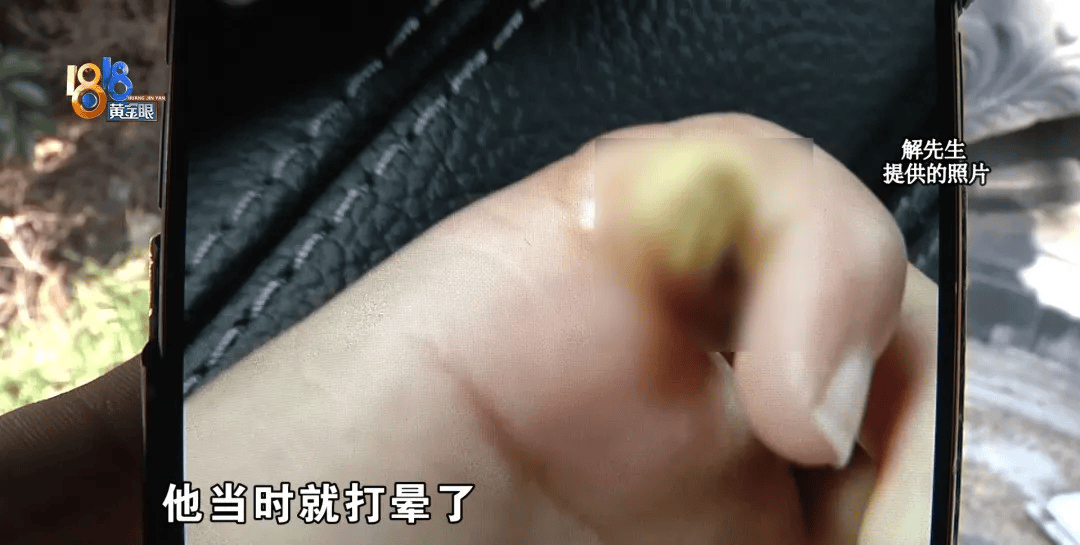 5岁男童瞬间晕厥<strong></p>
<p>普通电脑能挖那种虚拟币</strong>，筋都断了！街上常见，看见立即远离