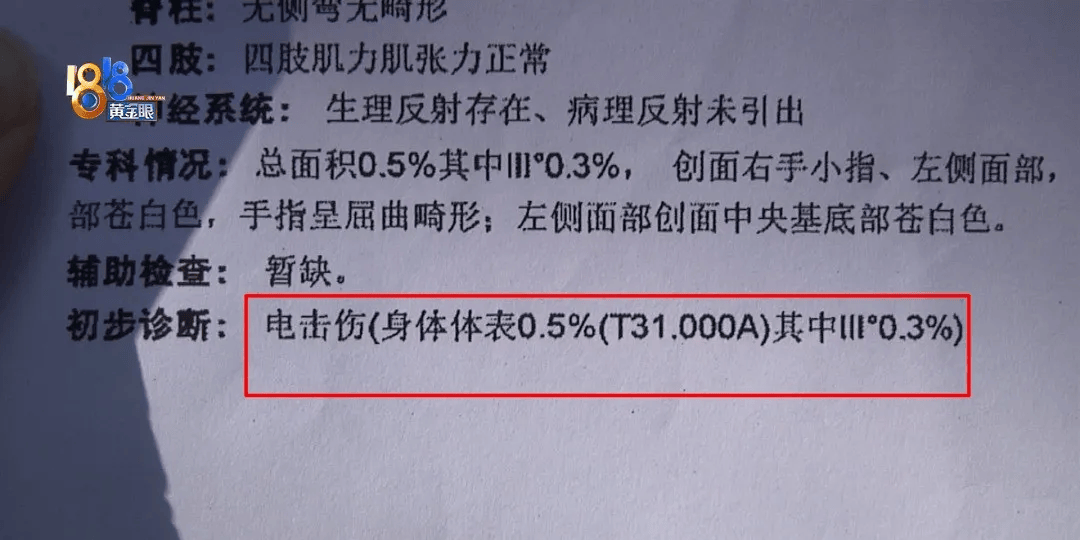 5岁男童瞬间晕厥<strong></p>
<p>普通电脑能挖那种虚拟币</strong>，筋都断了！街上常见，看见立即远离