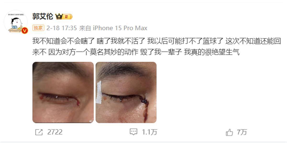 郭艾伦发文报平安：已顺利拆线<strong></p>
<p>艾拉尔虚拟币</strong>，相信一定会重回球场
