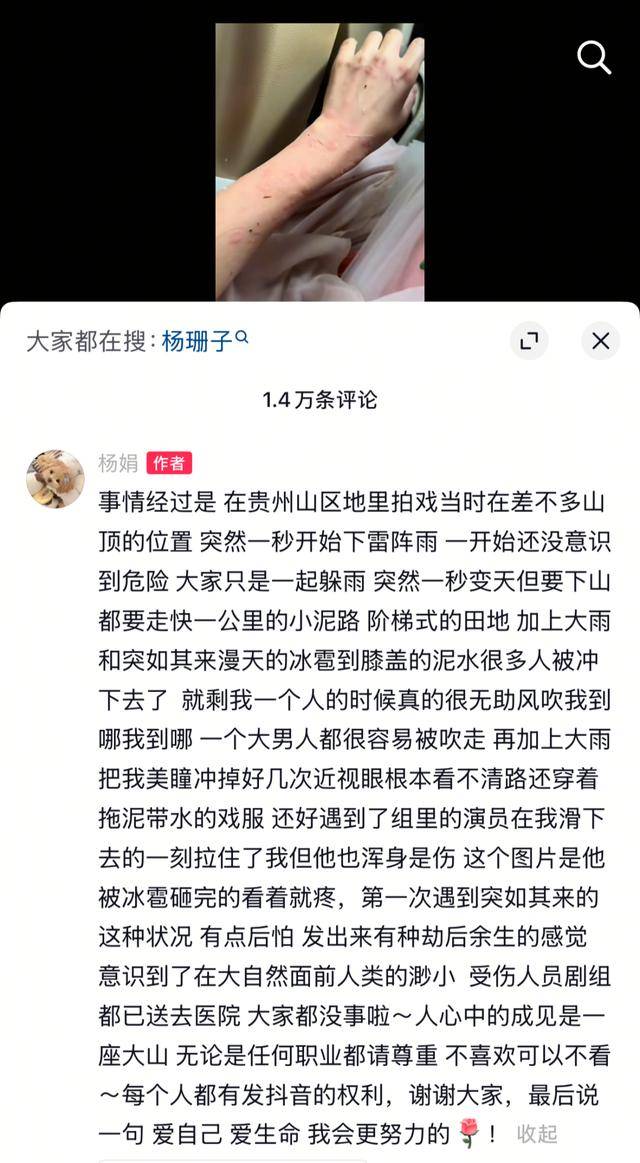 女演员贵州拍戏遇极端天气<strong></p>
<p>虚拟币uif</strong>，被冰雹砸伤！剧组伤员已送医