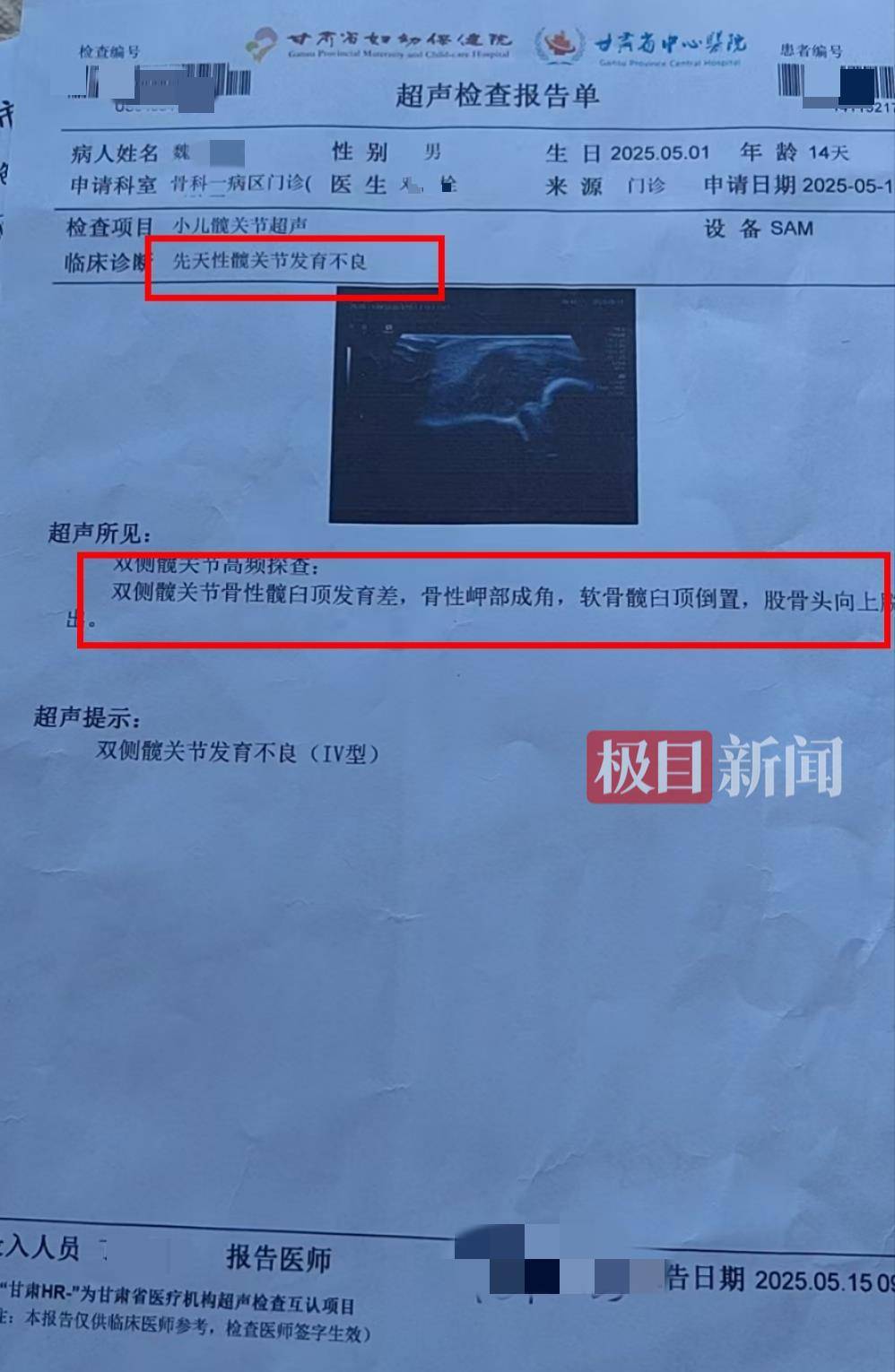 二胎出生查出先天性病症或落下残疾<strong>http虚拟币</p>，残疾父母称医院产检漏检、未尽告知义务，医院及医调委回应