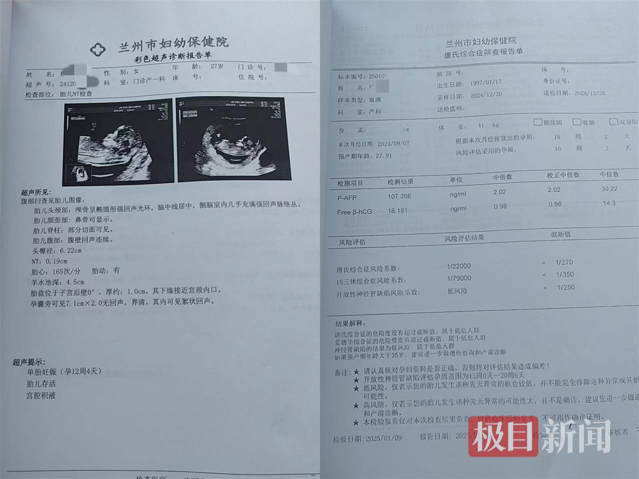 二胎出生查出先天性病症或落下残疾<strong>
</p>NT检查和唐氏综合征筛查（受访者供图）<p>
</strong>兰州市妇幼保健院医务科一名王姓工作人员对记者称，魏先生妻子在该医院产检的过程中，医护人员进行了常规产检</p>检查、唐氏综合征筛查，“高风险孕妇才做羊水穿刺，不是所有的孕妇都需要做。”另外，医院也在等基因检测结果。<p>
</p>甘肃省医调委一名工作人员对记者表示，医调委已关注到此事，会进行调解<p>http虚拟币<strong>。医调委请专家鉴定评估，需双方提供相关资料。目前，医调委已收到涉事医院的资料，但魏先生暂未提供资料。是否涉及医疗事故，魏先生可以向卫健委反映，卫健委会介入调查。</strong>
</p>（来源：极目新闻）<p>
                			    
			</div>
			<div class=