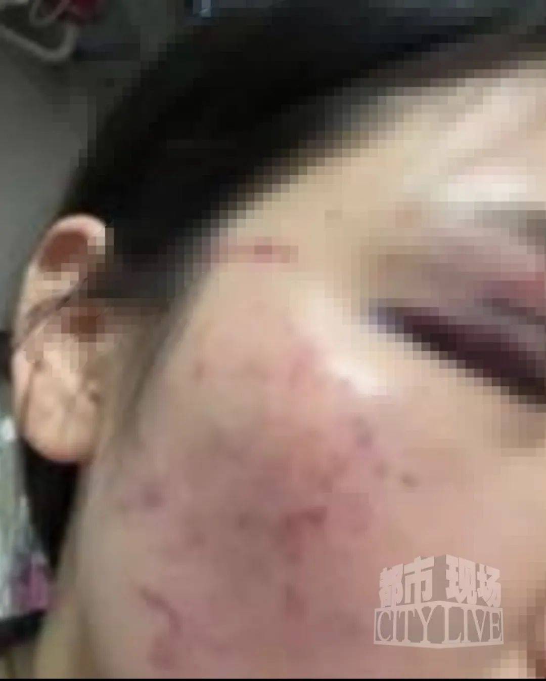 湖南衡阳29岁女子疑被男友施暴后从25楼跳下身亡 男友徐某此前还刺激说：“你放心<strong></p>
<p>虚拟币投资公司招聘</strong>，她不会去死的”