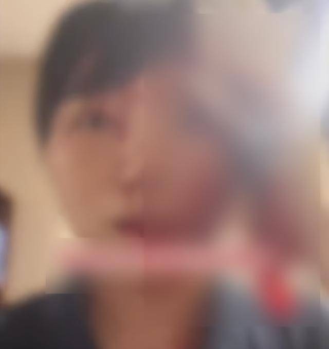缝了20多针！女子称被不知名男同事砸头毁容<strong></p>
<p>能看虚拟币走势的软件</strong>，警方介入