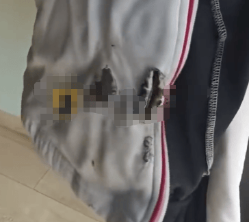 高中生散步时校服突发自燃<strong></p>
<p>虚拟币买卖委托价</strong>？原是165元网购的“宝”在惹祸→