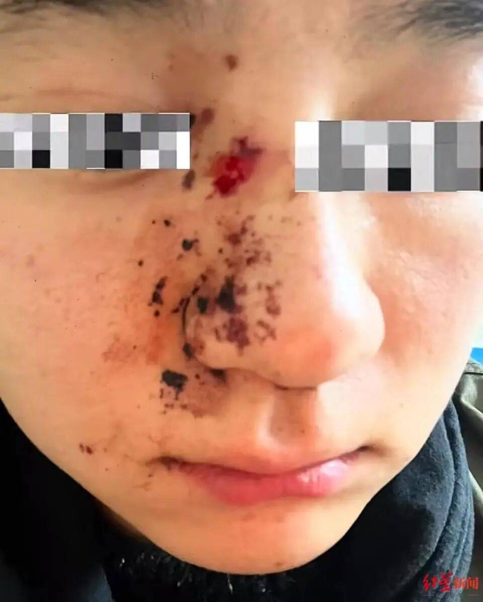 男子因质问女子遛狗不牵绳被打骨折<strong></p>
<p>人民币买虚拟币网站</strong>，当事人：打人者毫无悔意