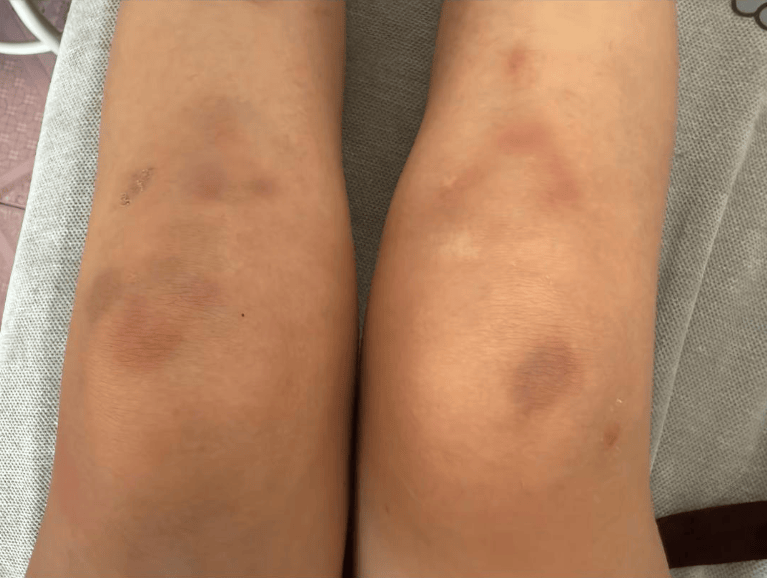 女子自称因工资问题被老板锁办公室里打 警方：双方已到派出所<strong></p>
<p>irc虚拟币交易</strong>，是否打人还在调查