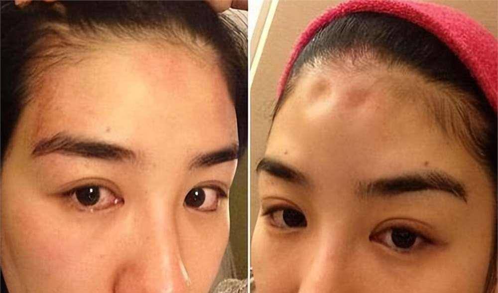 罗霖被家暴17年<strong></p>
<p>irc虚拟币交易</strong>，蓝洁瑛遭性侵暴力还被围观！女明星的暴力事件还有很多