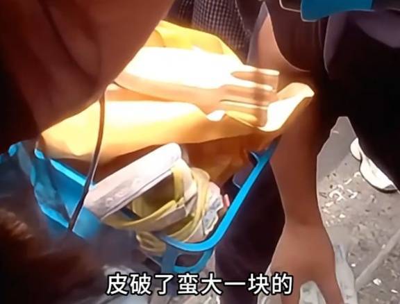 看着都疼<strong></p>
<p>虚拟货币炒币经验</strong>！上海街头一男子突然求助：10岁女儿被死死卡住！这个行为太危险→