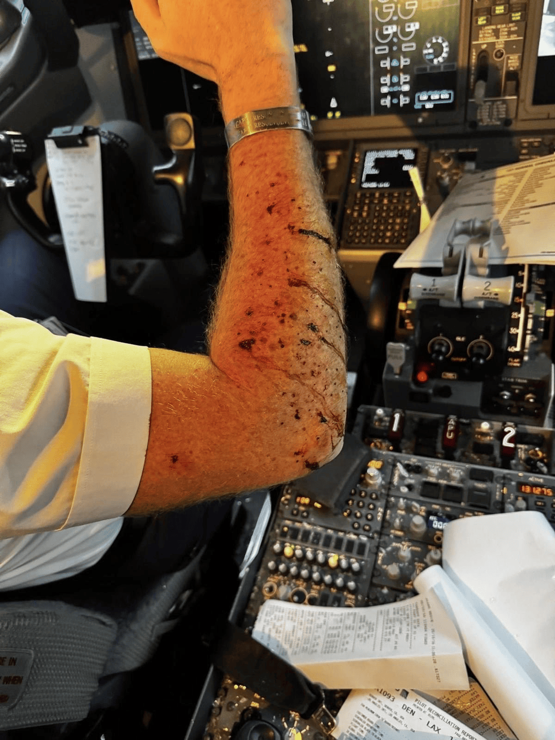 美客机驾驶舱风挡玻璃破裂<strong></p>
<p>区块链排名</strong>，自万米高空紧急备降！机上共140人，资深机长：或被陨石或卫星残骸撞击