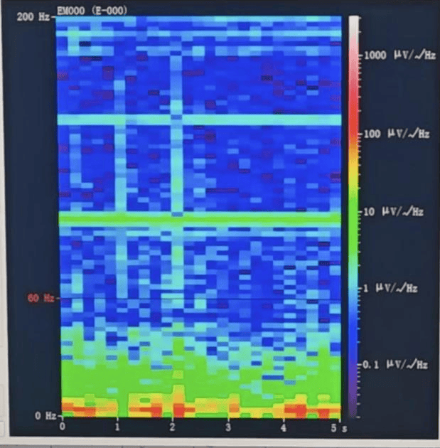 山西首例<strong></p>
<p>网站虚拟币对接钱包</strong>！山西省人民医院成功实施脑机接口辅助功能区脑肿瘤切除手术