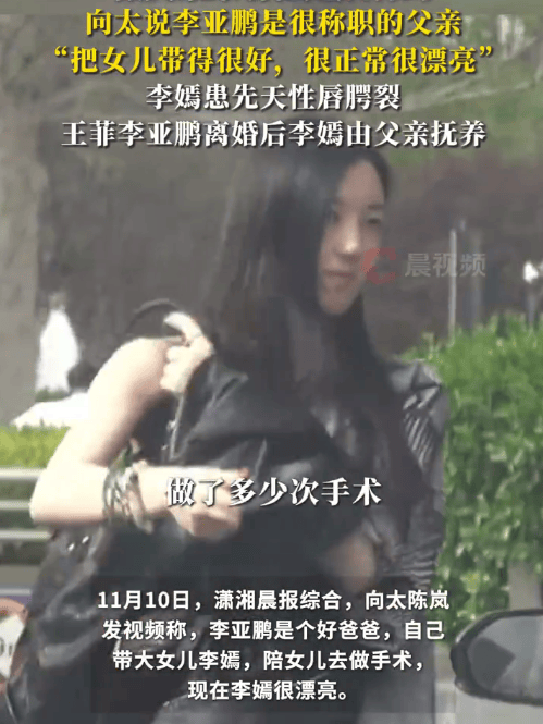 向太说李亚鹏是个好爸爸：<strong></p>
<p>xvg虚拟币价格</strong>他自己带大女儿李嫣还陪她做手术