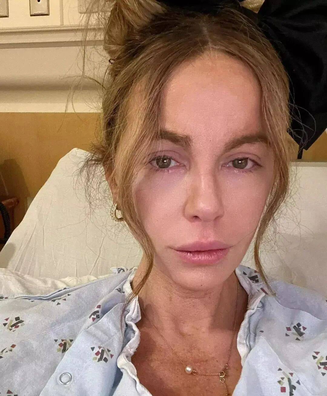 最美吸血鬼如今瘦成骷髅<strong></p>
<p>xvg虚拟币价格</strong>？《珍珠港》女主究竟怎么了？