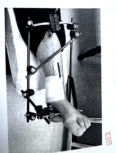 男子停车场随地小便被制止<strong></p>
<p>孔子币</strong>，恼羞成怒飞踹管理员致自己骨折，索赔18万余元，法院判了